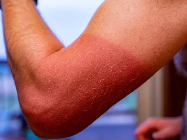 a person's subburned arm
